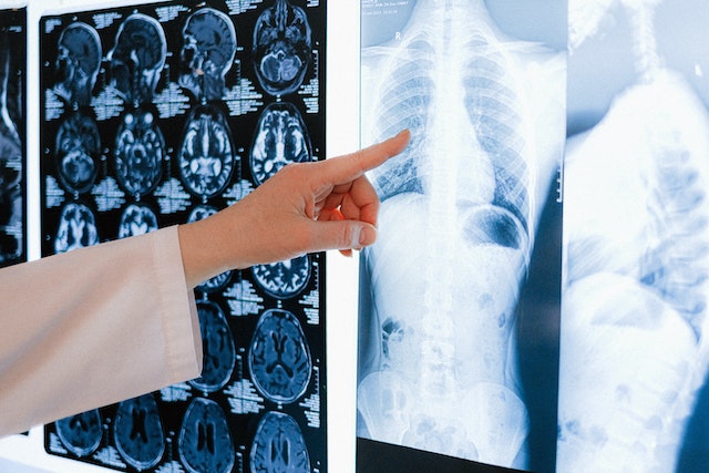 doctor pointing at x-ray scans